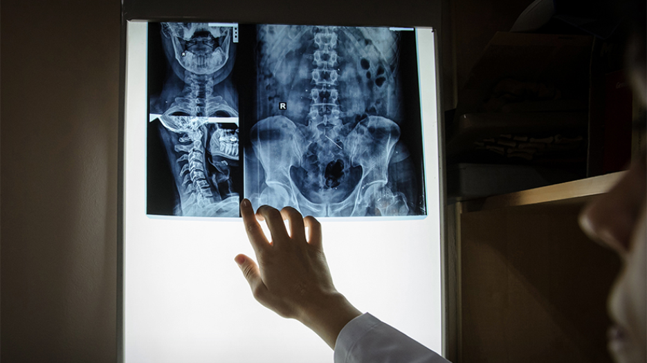 Hand pointing at x-ray of spine and skull